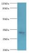 Caspase 6 antibody, LS-C375410, Lifespan Biosciences, Western Blot image 