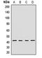 DnaJ Heat Shock Protein Family (Hsp40) Member B14 antibody, LS-C668301, Lifespan Biosciences, Western Blot image 