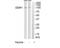Discoidin Domain Receptor Tyrosine Kinase 1 antibody, TA326146, Origene, Western Blot image 