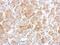 Cytochrome P450 Oxidoreductase antibody, NBP2-16083, Novus Biologicals, Immunohistochemistry paraffin image 