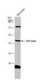 Transcription Factor AP-2 Beta antibody, NBP2-20606, Novus Biologicals, Western Blot image 