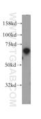 Transcription Factor EC antibody, 13547-1-AP, Proteintech Group, Western Blot image 