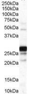 Catechol-O-Methyltransferase antibody, EB07357, Everest Biotech, Western Blot image 