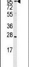 Endoplasmic Reticulum Aminopeptidase 1 antibody, PA5-15021, Invitrogen Antibodies, Western Blot image 