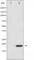 Eukaryotic Translation Initiation Factor 4E Binding Protein 1 antibody, abx010312, Abbexa, Western Blot image 