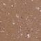 ER Membrane Associated RNA Degradation antibody, PA5-59705, Invitrogen Antibodies, Immunohistochemistry paraffin image 