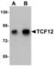 Transcription Factor 12 antibody, LS-B5344, Lifespan Biosciences, Western Blot image 