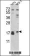 ARF6-Specific antibody, LS-C156452, Lifespan Biosciences, Western Blot image 