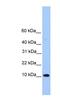 Trafficking Protein Particle Complex 6B antibody, NBP1-70736, Novus Biologicals, Western Blot image 