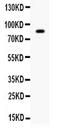 SMAD Specific E3 Ubiquitin Protein Ligase 2 antibody, PA5-80044, Invitrogen Antibodies, Western Blot image 