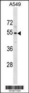 Pseudouridine Synthase 10 antibody, 60-817, ProSci, Western Blot image 