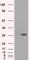 Tribbles Pseudokinase 2 antibody, MA5-24942, Invitrogen Antibodies, Western Blot image 