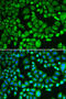 Proteasome 26S Subunit, Non-ATPase 7 antibody, 19-610, ProSci, Immunofluorescence image 