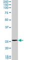 Phosphomannomutase 2 antibody, H00005373-M02, Novus Biologicals, Western Blot image 