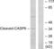 Caspase 6 antibody, abx015535, Abbexa, Western Blot image 