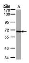 Polo Like Kinase 1 antibody, LS-B4225, Lifespan Biosciences, Western Blot image 