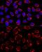 Adaptor Related Protein Complex 1 Subunit Mu 2 antibody, GTX33012, GeneTex, Immunocytochemistry image 