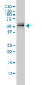 Parkin RBR E3 Ubiquitin Protein Ligase antibody, LS-C197846, Lifespan Biosciences, Western Blot image 