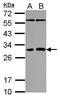 Platelet Activating Factor Acetylhydrolase 1b Catalytic Subunit 2 antibody, PA5-31152, Invitrogen Antibodies, Western Blot image 