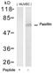 Paxillin antibody, 79-693, ProSci, Western Blot image 