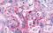 G Protein-Coupled Receptor 4 antibody, GTX70549, GeneTex, Immunohistochemistry paraffin image 