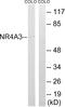 Nuclear Receptor Subfamily 4 Group A Member 3 antibody, A02578-1, Boster Biological Technology, Western Blot image 