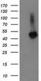 Tubulin Folding Cofactor E Like antibody, MA5-25481, Invitrogen Antibodies, Western Blot image 