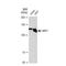 Sirtuin 1 antibody, GTX00951, GeneTex, Western Blot image 