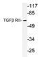 Transforming Growth Factor Beta Receptor 2 antibody, AP20273PU-N, Origene, Western Blot image 