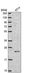 NCK Interacting Protein With SH3 Domain antibody, PA5-65592, Invitrogen Antibodies, Western Blot image 