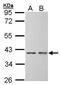 Small Glutamine Rich Tetratricopeptide Repeat Containing Alpha antibody, PA5-21364, Invitrogen Antibodies, Western Blot image 