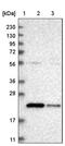Spermidine/Spermine N1-Acetyltransferase Family Member 2 antibody, PA5-54566, Invitrogen Antibodies, Western Blot image 