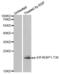 Eukaryotic Translation Initiation Factor 4E Binding Protein 1 antibody, abx000392, Abbexa, Western Blot image 