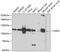 Alanyl-TRNA Synthetase antibody, GTX64565, GeneTex, Western Blot image 