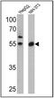Peroxisome Proliferator Activated Receptor Alpha antibody, PA3-820, Invitrogen Antibodies, Western Blot image 
