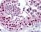 Metastasis Associated 1 Family Member 2 antibody, orb87620, Biorbyt, Immunohistochemistry paraffin image 
