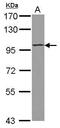 ST18 C2H2C-Type Zinc Finger Transcription Factor antibody, PA5-31964, Invitrogen Antibodies, Western Blot image 