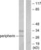 Ubiquitin C-Terminal Hydrolase L1 antibody, LS-B5981, Lifespan Biosciences, Western Blot image 