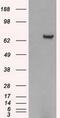 Histone Deacetylase 10 antibody, GTX84388, GeneTex, Western Blot image 