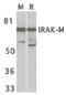 Interleukin 1 Receptor Associated Kinase 3 antibody, PA5-19969, Invitrogen Antibodies, Western Blot image 