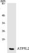 ATP Synthase Membrane Subunit G Like antibody, LS-C200159, Lifespan Biosciences, Western Blot image 