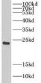 DIRAS Family GTPase 1 antibody, FNab02392, FineTest, Western Blot image 