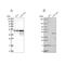 Transcription Factor AP-2 Alpha antibody, NBP1-90143, Novus Biologicals, Western Blot image 