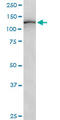 Unc-51 Like Autophagy Activating Kinase 1 antibody, LS-C198556, Lifespan Biosciences, Western Blot image 