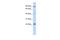 INSIG2 antibody, A03906, Boster Biological Technology, Western Blot image 