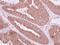 NME/NM23 Family Member 9 antibody, NBP2-15152, Novus Biologicals, Immunohistochemistry paraffin image 