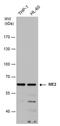 Malic Enzyme 2 antibody, PA5-78057, Invitrogen Antibodies, Western Blot image 