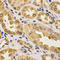 Paraoxonase 2 antibody, A02027, Boster Biological Technology, Immunohistochemistry paraffin image 