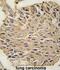 Aldolase, Fructose-Bisphosphate A antibody, abx031667, Abbexa, Immunohistochemistry paraffin image 