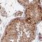 SIK Family Kinase 3 antibody, NBP2-47278, Novus Biologicals, Immunohistochemistry paraffin image 